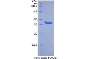 SDS-PAGE analysis of Human ABCG1 Protein.