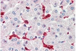 Human Liver (formalin-fixed, paraffin-embedded) stained with HMOX1 antibody ABIN462109 at 10 ug/ml followed by biotinylated goat anti-rabbit IgG secondary antibody ABIN481713, alkaline phosphatase-streptavidin and chromogen. (HMOX1 antibody)