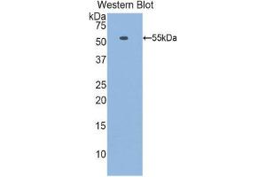 Western Blotting (WB) image for anti-Laminin, beta 1 (LAMB1) (AA 1053-1258) antibody (ABIN1859602) (Laminin beta 1 antibody  (AA 1053-1258))