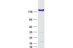 Validation with Western Blot (INPP5D Protein (Transcript Variant 2) (Myc-DYKDDDDK Tag))