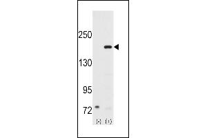 Western blot analysis of SRC1 (arrow) using rabbit polyclonal SRC1 Antibody (N-term) (ABIN391824 and ABIN2841669). (NCOA1 antibody  (N-Term))