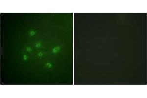 Immunofluorescence analysis of A549 cells, using DAPK3 (Phospho-Thr265) Antibody. (DAPK3 antibody  (pThr265))