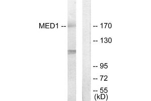 Western blot analysis of extracts from Jurkat cells, using MED1 antibody. (MED1 antibody  (Internal Region))