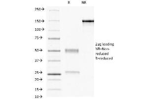 SDS-PAGE Analysis Purified Progesterone Receptor Mouse Monoclonal Antibody (PR484). (Progesterone Receptor antibody)