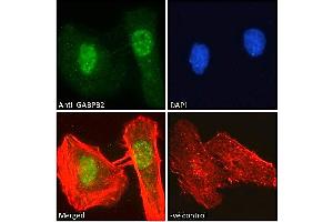 ABIN190778 Immunofluorescence analysis of paraformaldehyde fixed HeLa cells, permeabilized with 0. (GABPB2 antibody  (Internal Region))