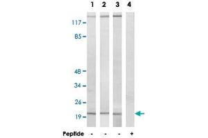Western blot analysis of extracts from COLO cells (Lane 1), HUVEC cells (Lane 2) and HeLa cells (Lane 3 and lane 4), using MRPL20 polyclonal antibody .