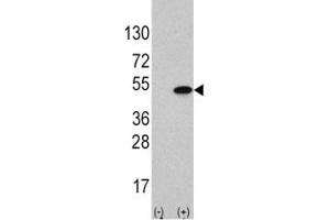 Western blot analysis of ATF4 antibody and 293 cell lysate (2 ug/lane) either nontransfected (Lane 1) or transiently transfected with the ATF4 gene (2). (ATF4 antibody  (AA 220-252))
