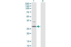 Western Blot analysis of HSD11B1 expression in transfected 293T cell line by HSD11B1 monoclonal antibody (M02A), clone 2C10. (HSD11B1 antibody  (AA 1-292))