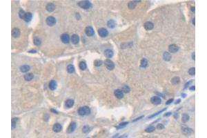 Detection of NSF in Human Stomach Tissue using Polyclonal Antibody to N-Ethylmaleimide Sensitive Factor (NSF) (NSF antibody  (AA 590-744))