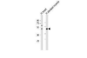 All lanes : Anti-ISLR Antibody (C-term) at 1:1000 dilution Lane 1: human heart lysate Lane 2: human skeletal muscle lysate Lysates/proteins at 20 μg per lane. (ISLR antibody  (C-Term))