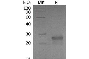 Western Blotting (WB) image for Ectodysplasin A2 Receptor (EDA2R) protein (His tag) (ABIN7320722) (Ectodysplasin A2 Receptor Protein (EDA2R) (His tag))