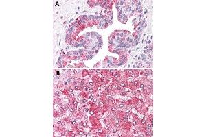 Immunohistochemical staining of formalin-fixed, paraffin-embedded human prostate (A) and human liver (B) tissue after heat-induced antigen retrieval. (ERAP1 antibody  (Internal Region))