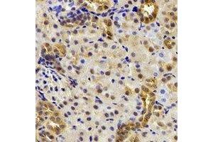 Immunohistochemical analysis of DDX39A staining in mouse kidney formalin fixed paraffin embedded tissue section.