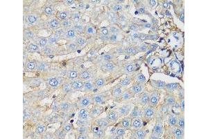 Immunohistochemistry of paraffin-embedded Rat liver using PROCR Polyclonal Antibody at dilution of 1:200 (40x lens). (PROCR antibody)