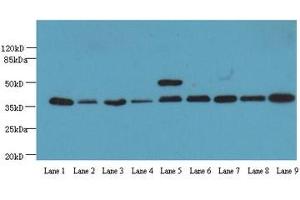 Western Blotting (WB) image for anti-Glyceraldehyde-3-Phosphate Dehydrogenase (GAPDH) (AA 3-105) antibody (ABIN4219317) (GAPDH antibody  (AA 3-105))