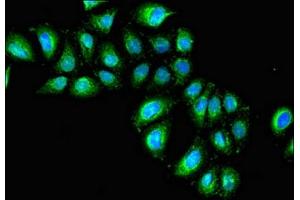 Immunofluorescent analysis of A549 cells using ABIN7156745 at dilution of 1: 100 and Alexa Fluor 488-congugated AffiniPure Goat Anti-Rabbit IgG(H+L) (IL1R1 antibody  (AA 18-320))