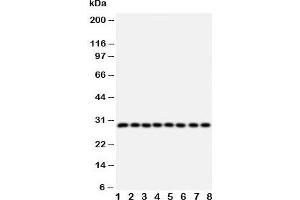 Western blot testing of CISH antibody and Lane 1:  rat liver;  2: rat kidney; and human samples  3: placenta;  4: A431;  5: SMMC-7721;  6: HeLa;  7: COLO320;  8: MM231 cell lysate (CISH antibody  (AA 241-258))