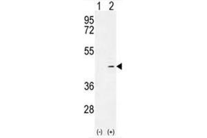 Western blot analysis of ADH4 (arrow) using rabbit polyclonal ADH4 Antibody (C-term) .