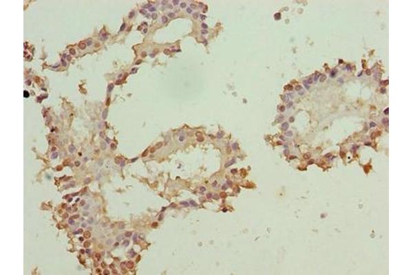 ZNF184 anticorps  (AA 1-751)