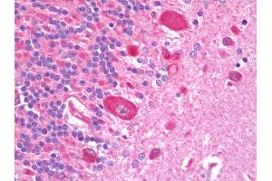 Immunohistochemistry (IHC) image for anti-Tumor Necrosis Factor Receptor Superfamily, Member 11a, NFKB Activator (TNFRSF11A) antibody (FITC) (ABIN1957175)