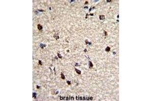 Immunohistochemistry (IHC) image for anti-Dermatopontin (DPT) antibody (ABIN3003244) (Dermatopontin antibody)