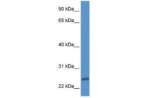 Western Blot showing PI15 antibody used at a concentration of 1 ug/ml against Fetal Heart Lysate