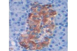 Immunohistochemistry (IHC) image for anti-Histone H2A Type 1-H (HIST1H2AH) (AA 1-128) antibody (ABIN1859161)