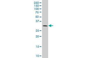 BRMS1 monoclonal antibody (M01), clone 2D4-2G11. (BRMS1 antibody  (AA 1-246))