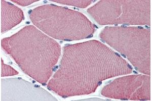 Human Skeletal Muscle: Formalin-Fixed, Paraffin-Embedded (FFPE)