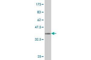 Western Blot detection against Immunogen (36. (IGFBPI antibody  (AA 160-259))