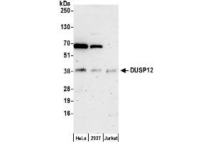 anti-Dual Specificity Phosphatase 12 (DUSP12) (AA 1-50) antibody