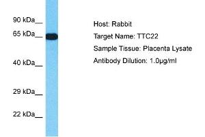 Host: Rabbit Target Name: TTC22 Sample Type: Placenta lysates Antibody Dilution: 1. (TTC22 antibody  (N-Term))