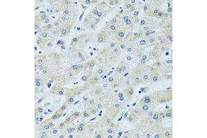Immunohistochemistry of paraffin-embedded human liver using SLC5A6 antibody (ABIN6292573) at dilution of 1:100 (40x lens). (SLC5A6 antibody)