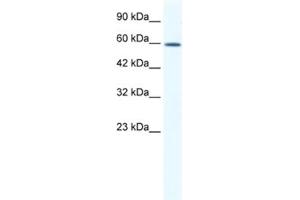 Western Blotting (WB) image for anti-DEAD (Asp-Glu-Ala-Asp) Box Polypeptide 5 (DDX5) antibody (ABIN2461339) (DDX5 antibody)