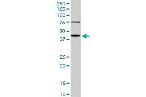 Western Blotting (WB) image for anti-Abhydrolase Domain Containing 5 (ABHD5) (AA 1-349) antibody (ABIN565526)