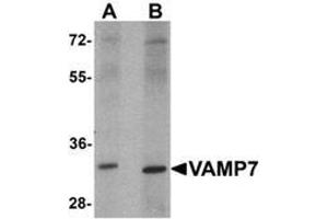 Western blot analysis of VAMP7 in mouse lung tissue lysate with VAMP7 Antibody  at 1 ug/mL. (VAMP7 antibody  (N-Term))