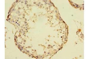 Immunohistochemistry of paraffin-embedded human testis tissue using ABIN7172395 at dilution of 1:100 (TCN1 antibody  (AA 24-433))