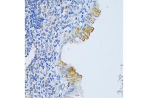 Immunohistochemistry of paraffin-embedded human appendix using CRA antibody (ABIN6132087, ABIN6138999, ABIN6139001 and ABIN6217973) at dilution of 1:150 (40x lens). (EFCAB4B antibody  (AA 1-200))