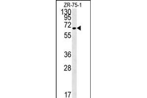 N4BP3 Antibody (N-term) (ABIN651821 and ABIN2840413) western blot analysis in ZR-75-1 cell line lysates (15 μg/lane).