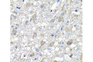 Immunohistochemistry of paraffin-embedded Rat brain using MTX1 Polyclonal Antibody at dilution of 1:100 (40x lens). (Metaxin 1 antibody)