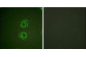 Immunofluorescence analysis of HuvEc cells, using HER3 (Ab-1222) Antibody. (ERBB3 antibody  (AA 1191-1240))