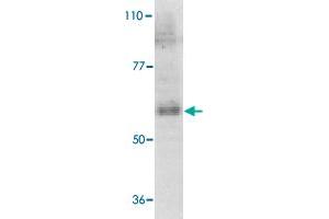 Western blot analysis of IL21R expression in human Raji cell lysate with IL21R polyclonal antibody  at 1 ug /mL .