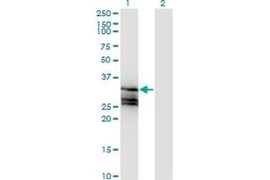 Western Blot analysis of HAGH expression in transfected 293T cell line by HAGH monoclonal antibody (M02A), clone 2F9. (HAGH antibody  (AA 161-260))