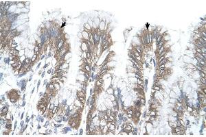 Human Stomach (RSRC2 antibody  (C-Term))