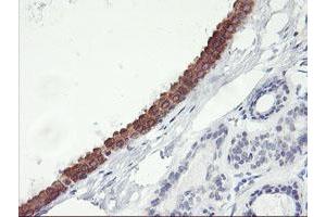 Immunohistochemical staining of paraffin-embedded Human breast tissue using anti-C20orf3 mouse monoclonal antibody. (APMAP antibody)