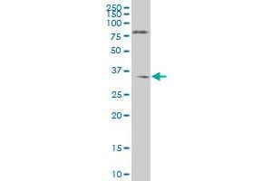 NKX6-1 monoclonal antibody (M01), clone 1B7 Western Blot analysis of NKX6-1 expression in HL-60 . (NKX6-1 antibody  (AA 191-275))