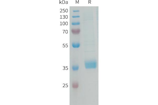 MFAP4 Protein (AA 22-255) (His tag)