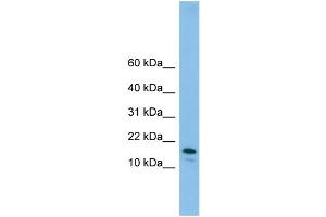 WB Suggested Anti-GREM2 Antibody Titration: 0.