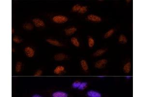Immunofluorescence analysis of U-2 OS cells using ADNP Polyclonal Antibody at dilution of 1:100 (40x lens).
