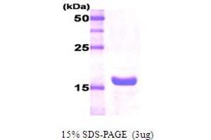 Figure annotation denotes ug of protein loaded and % gel used. (Pituitary Growth Hormone 20kDa Protein)